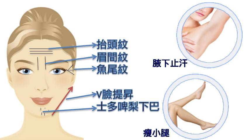 Botox Treatment part
