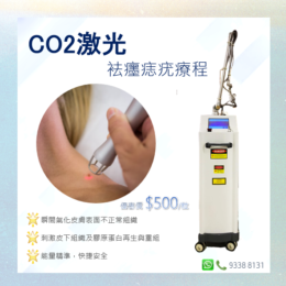 CO2激光